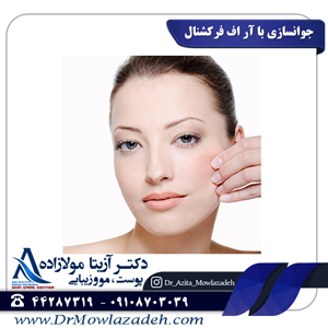 جوانسازی-با-آر-اف-فرکشنال