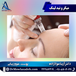 میکرونیدلینگ