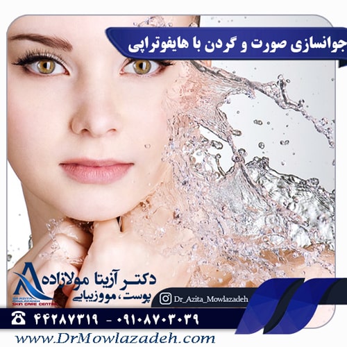 جوانسازی صورت و گردن با هایفوتراپی