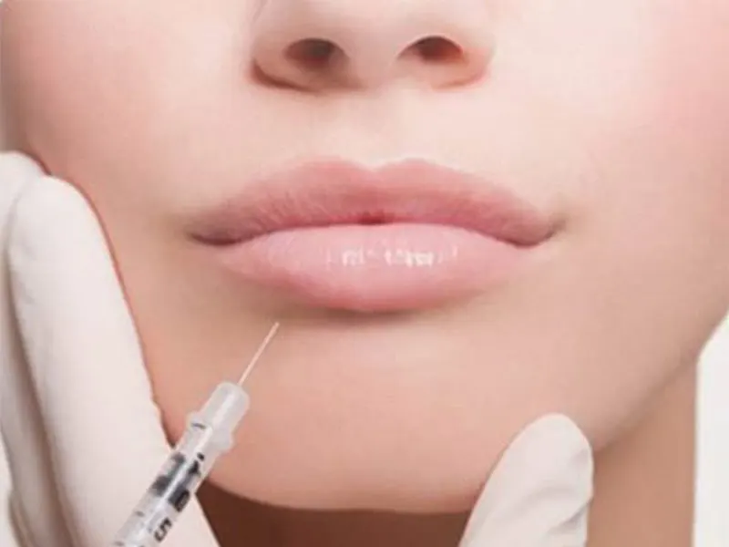 قیمت تزریق ژل لب